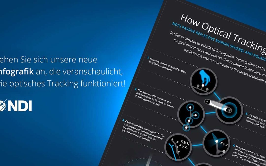 Wie funktioniert optisches Tracking?